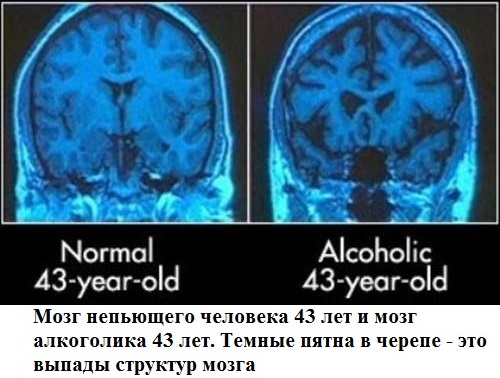 Вред курения, алкоголизма и наркотических веществ